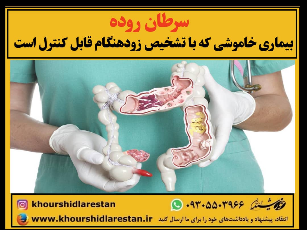 سرطان روده؛ بیماری خاموشی که با تشخیص زودهنگام قابل کنترل است/ پس از ۵۰ سالگی، همه افراد باید هر ۱۰ سال یک‌بار کولونوسکوپی انجام دهند